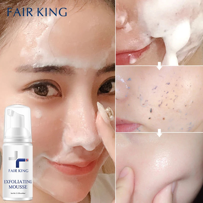 Mousse Exfoliante Facial Peeling Gel Exfoliante Facial